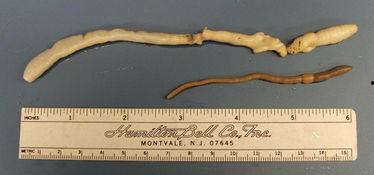 蚯蚓头部图片,解剖图解揭示生命奇迹